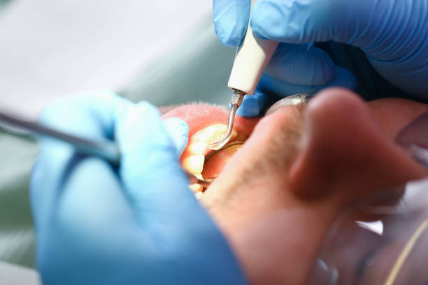 Best Emergency Treatment for Oral Infections in Antelope, CA