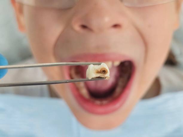 Best Emergency Denture Repair in Antelope, CA